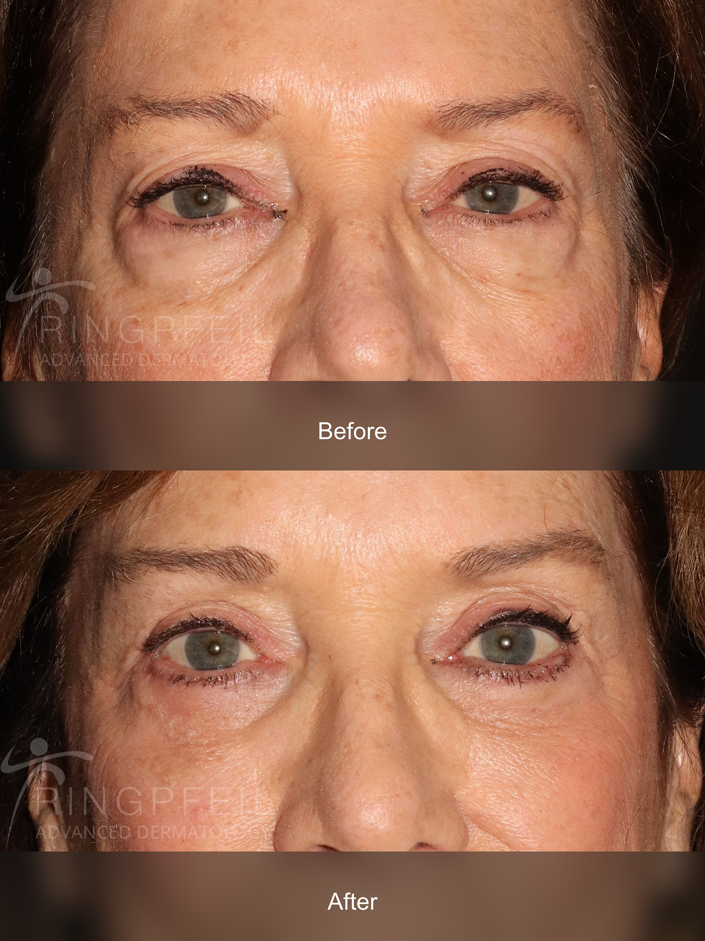 Catherine Smith before and after