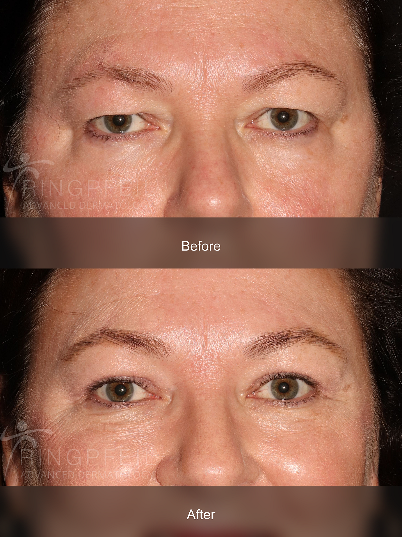 Colleen McMahon before and after