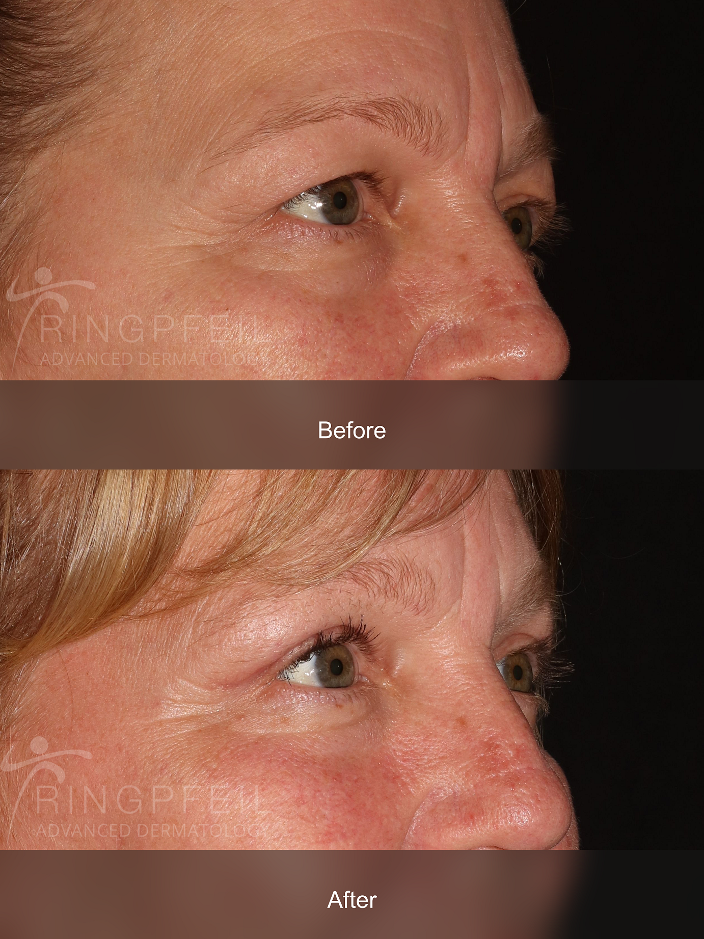 Dawn Kirkman before and after