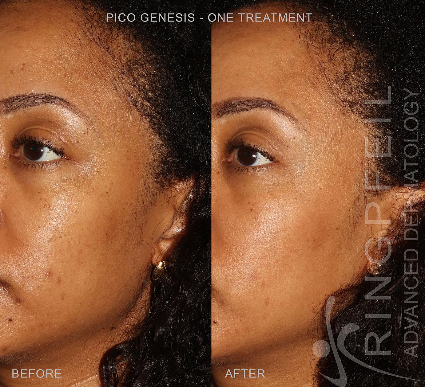 dermatosis treatment in Philadelphia